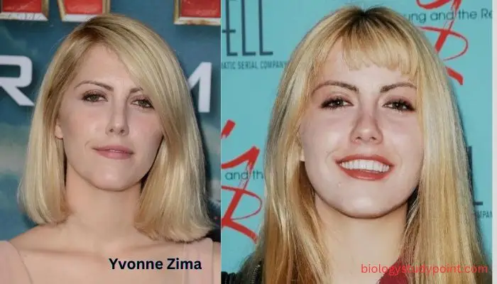 Yvonne Zima net worth